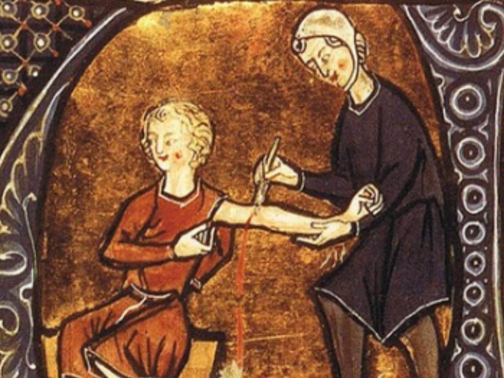 Aches, Pains and Leeches: Introducing Medieval Medicine 2022 | What's on in Sydney